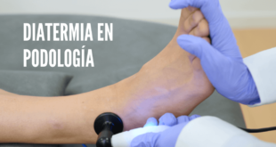 Diatermia en podologia