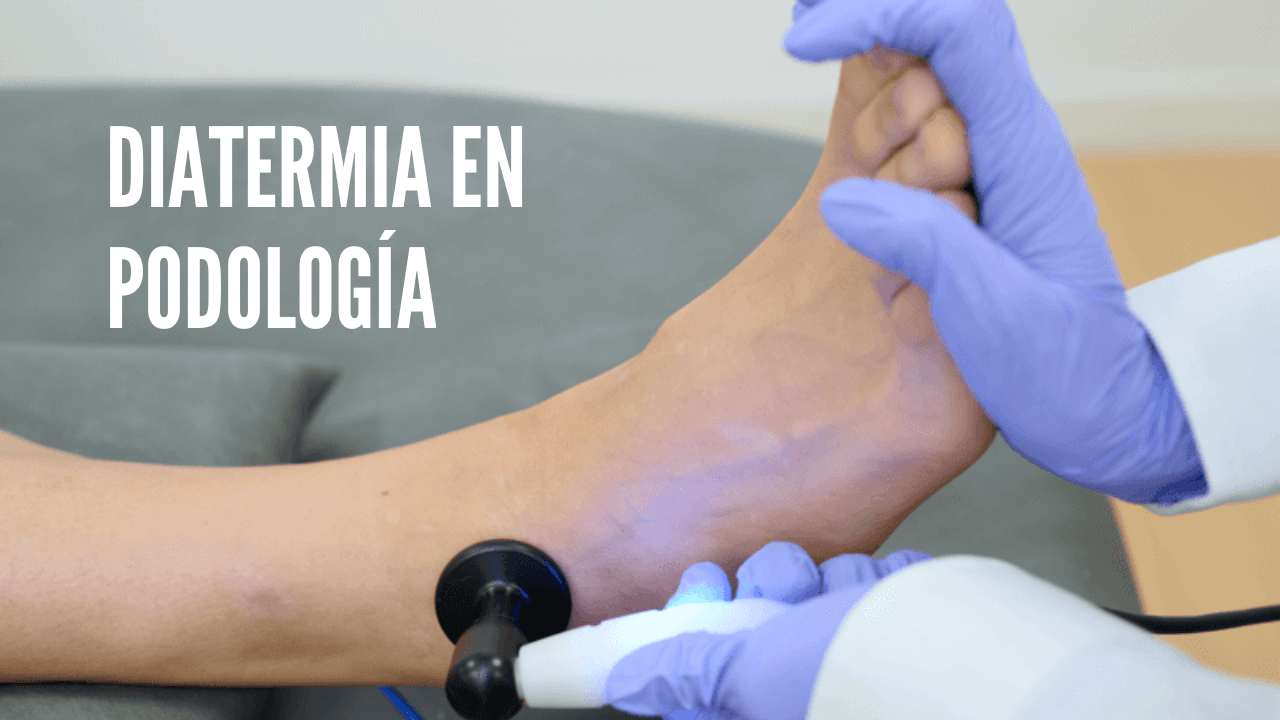 Diatermia en podologia