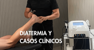 Diatermia y casos clínicos