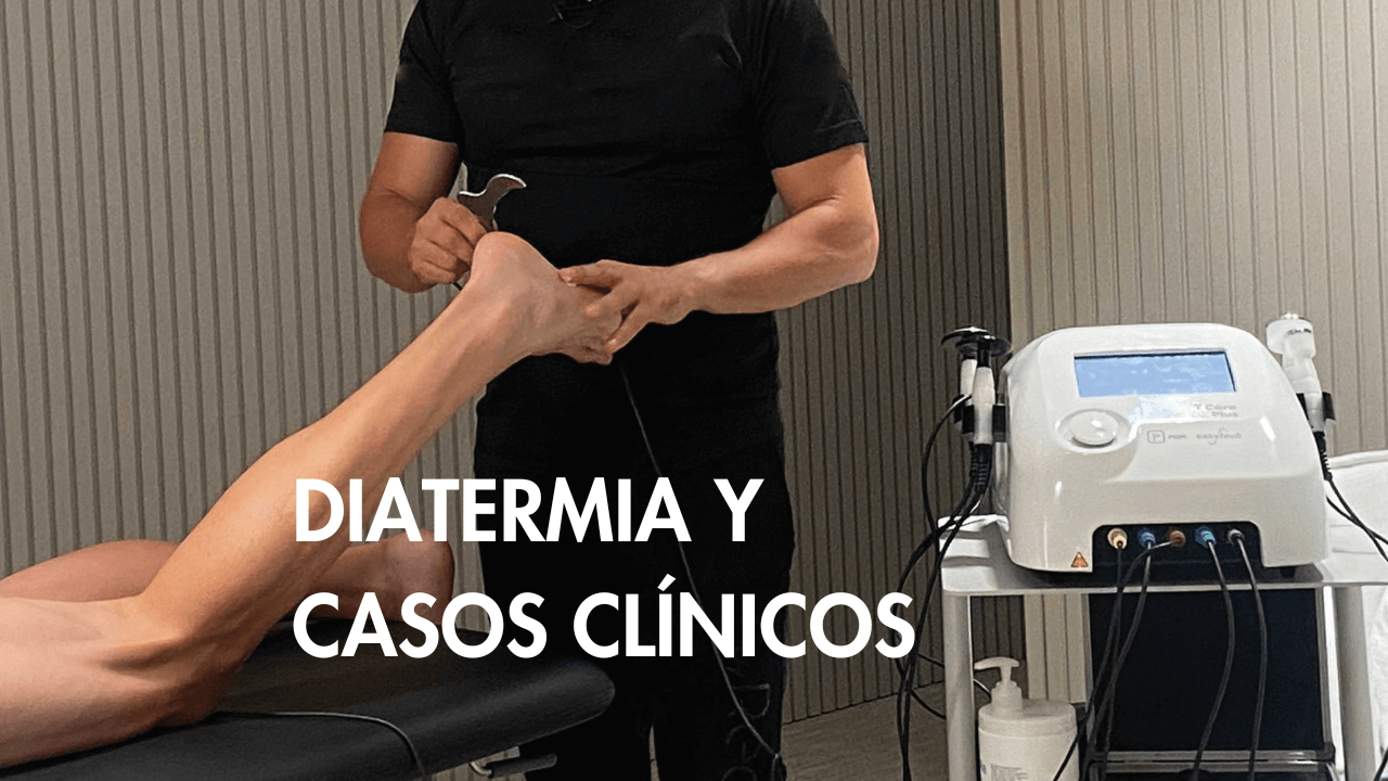 Diatermia y casos clínicos